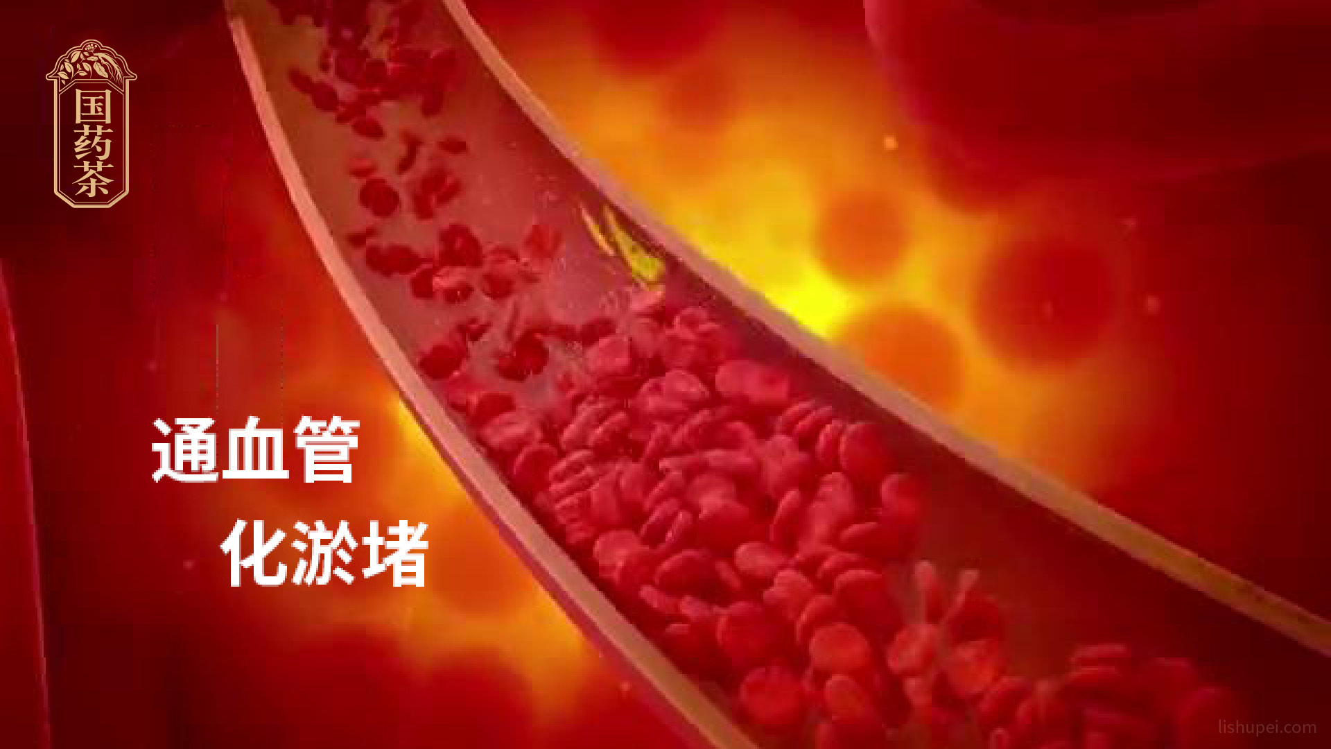 通血管